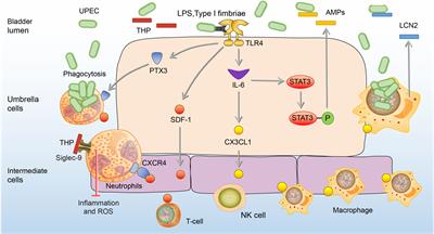 The immune responses to different Uropathogens call individual interventions for bladder infection